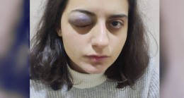 HEDEP Gençlik Meclisi Sözcüsü Edanur İbrahimoğlu’na polis şiddeti