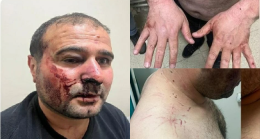 Hakkari’de polis şiddeti: İfadeye çağrıldığı karakolda darp edildi