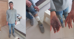 19 yaşındaki gence gözaltında işkence iddiası