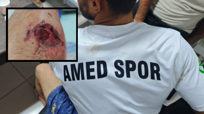 Amedspor forması giyen işçilere saldırı